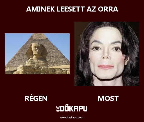 Aminek leesett az orra
 
 title=