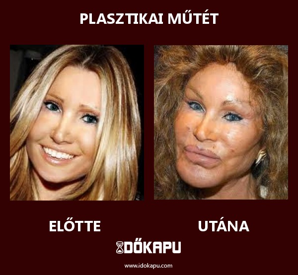 PLASZTIKAI MŰTÉT
title=